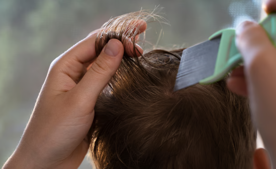 Do I Have Lice Or Am I Paranoid? Sorting Facts From Fear |Pudelek