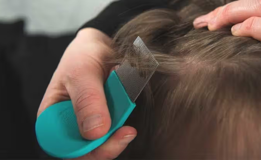 How Are Lice Diagnosed?