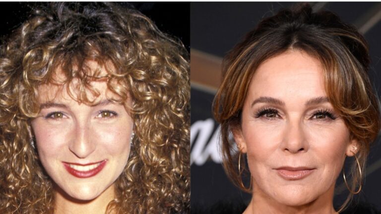 jennifer grey before and after rhinoplasty